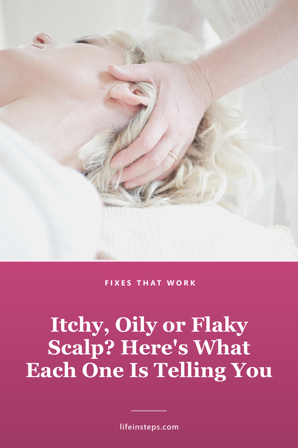 Pinterest pin: Itchy, Oily or Flaky Scalp? Here's What Each One Is Telling You